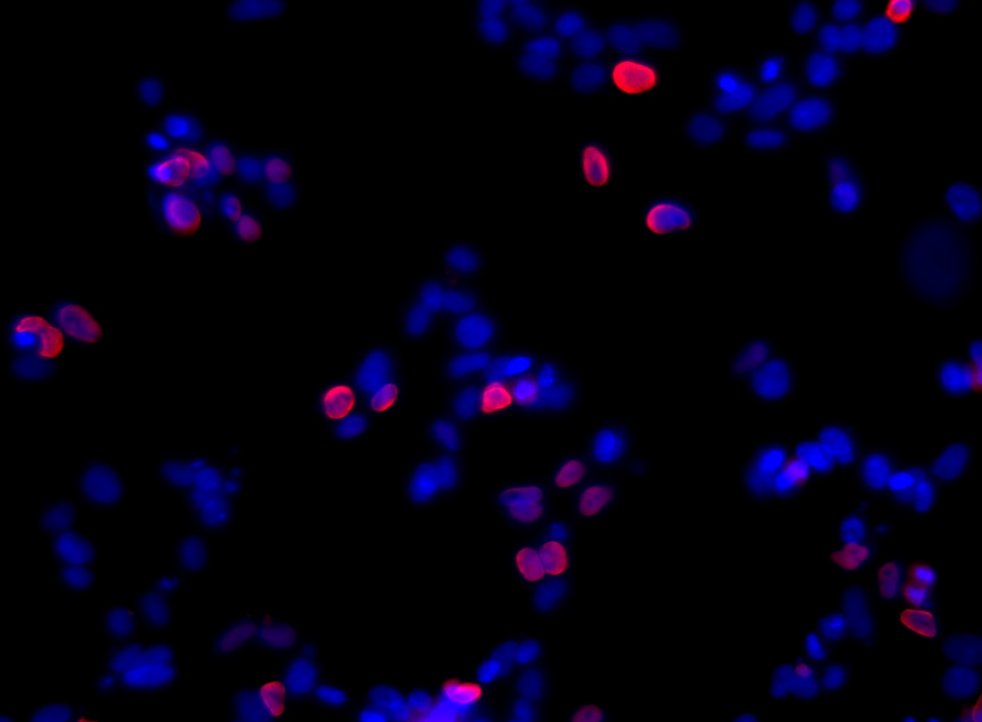 Nkx2-2-293F_AF647_Image.png